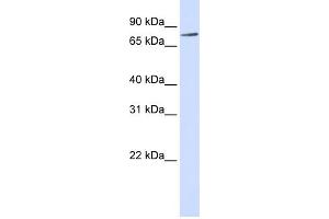 WB Suggested Anti-RIPK4 Antibody Titration:  0. (RIPK4 抗体  (Middle Region))