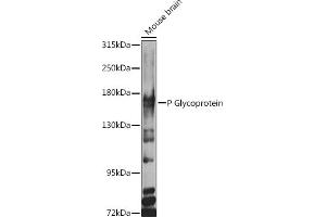 Western blot analysis of extracts of various cell lines, using P Glycoprotein antibody (ABIN6129943, ABIN6136341, ABIN6136344 and ABIN6216612) at 1:1000 dilution.