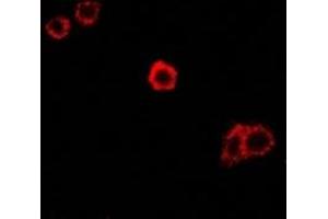 Immunofluorescent analysis of SPAM1 staining in Hela cells. (SPAM1 抗体)