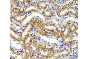 Immunohistochemistry of paraffin-embedded Mouse kidney using ZFAND3 Polyclonal Antibody at dilution of 1:100 (40x lens). (ZFAND3 抗体)