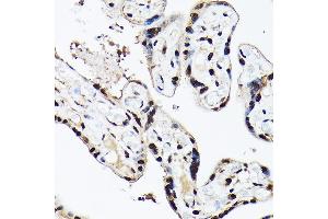 Immunohistochemistry of paraffin-embedded human placenta using A Rabbit pAb (ABIN6129868, ABIN6136479, ABIN6136480 and ABIN6221034) at dilution of 1:100 (40x lens). (BAF53A 抗体  (AA 1-280))