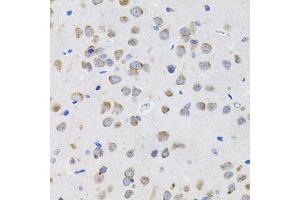Immunohistochemistry of paraffin-embedded rat brain using IL13 antibody (ABIN5971115) (40x lens). (IL-13 抗体)