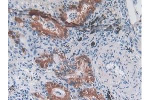 Immunohistochemistry (IHC) image for anti-Myostatin (MSTN) (AA 267-375) antibody (ABIN7433885)