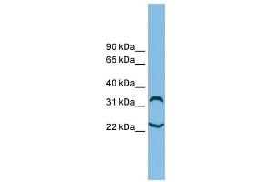 C6orf134 antibody used at 1 ug/ml to detect target protein. (Chromosome 6 Open Reading Frame 134 (C6orf134) (N-Term) 抗体)