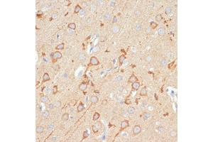 Immunohistochemistry (IHC) image for anti-Glutamate Receptor 1 (GLUR1) (AA 19-300) antibody (ABIN3015589)