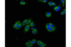 Immunofluorescence staining of HepG2 cells with ABIN7161148 at 1:125, counter-stained with DAPI. (Nephrin 抗体  (AA 23-257))