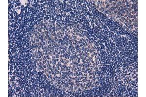 Image no. 3 for anti-Eukaryotic Translation Initiation Factor 4E Family Member 2 (EIF4E2) antibody (ABIN1497992) (EIF4E2 抗体)