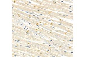 Immunohistochemistry of paraffin embedded rat heart using CDH19 (ABIN7073258) at dilution of 1:500 (400x lens) (CDH19 抗体)