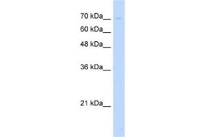 WB Suggested Anti-UNC93B1 Antibody Titration:  5. (UNC93B1 抗体  (N-Term))