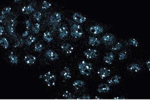Immunofluorescence staining of A431 cells (Human epithelial carcinoma, ATCC CRL-1555). (NPAT 抗体  (AA 681-803))