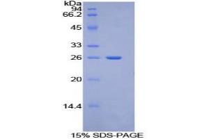 SDS-PAGE analysis of Mouse Torsin 2A Protein. (TOR2A 蛋白)