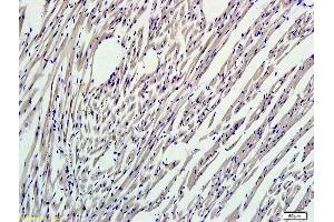 Formalin-fixed and paraffin embedded mouse myocardium labeled with (ABIN737271) Rabbit Anti-Nrf2 Polyclonal Antibody, Unconjugated 1:300 followed by conjugation to the secondary antibody and DAB staining (NRF2 抗体  (AA 430-480))