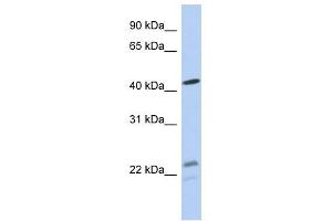 BCKDHA antibody used at 1 ug/ml to detect target protein. (BCKDHA 抗体  (N-Term))