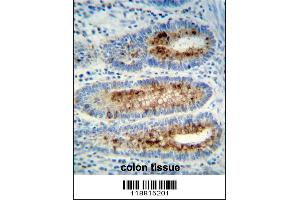 Myeloperoxidase Antibody immunohistochemistry analysis in formalin fixed and paraffin embedded human colon tissue followed by peroxidase conjugation of the secondary antibody and DAB staining.