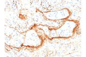 Formalin-fixed, paraffin-embedded human Small Intestine stained with Monospecific Mouse Monoclonal Antibody (ELN/1981) to Elastin. (Elastin 抗体)