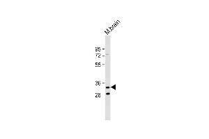 Anti-TMEM106B Antibody (C-Term) at 1:2000 dilution + Mouse brain lysate Lysates/proteins at 20 μg per lane. (TMEM106B 抗体  (AA 218-252))