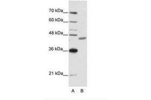 Image no. 1 for anti-Zinc Finger Protein 396 (ZNF396) (N-Term) antibody (ABIN6736192) (ZNF396 抗体  (N-Term))