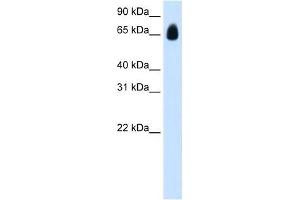 Western Blot showing TRIM32 antibody used at a concentration of 1. (TRIM32 抗体  (C-Term))