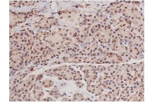 ABIN6269133 at 1/200 staining Human pancreas tissue sections by IHC-P. (KIT 抗体  (Internal Region))