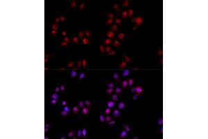 Immunofluorescence analysis of HeLa cells using HMGB1 antibody (ABIN5971378) at dilution of 1/100 (40x lens). (HMGB1 抗体)