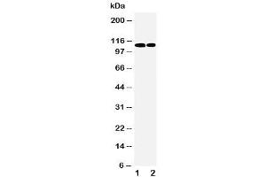 Western blot testing of p107 antibody and Lane 1:  239T (p107 抗体  (C-Term))