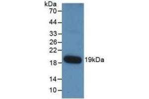 WB of Protein Standard: different control antibodies against Highly purified E. (Angiopoietin 1 CLIA Kit)