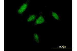 Immunofluorescence of purified MaxPab antibody to CCND3 on HeLa cell. (Cyclin D3 抗体  (AA 1-292))