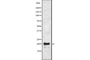 Western blot analysis of ADM using A549 whole cell lysates (Adrenomedullin 抗体  (N-Term))