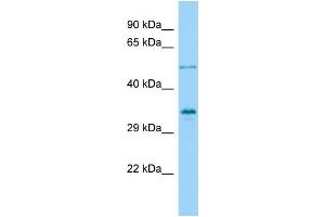 Host: Rabbit Target Name: VGLL4 Sample Type: OVCAR-3 Whole Cell lysates Antibody Dilution: 1. (VGLL4 抗体  (Middle Region))