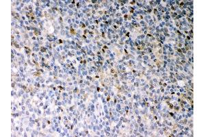 Immunohistochemistry (IHC) image for anti-Spleen Focus Forming Virus (SFFV) Proviral Integration Oncogene Spi1 (SPI1) (AA 18-196) antibody (ABIN3043440)