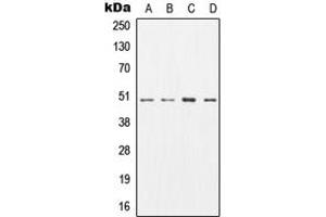 Western blot analysis of AP2M1 expression in SKBR3 (A), MCF7 (B), mouse brain (C), rat brain (D) whole cell lysates. (AP2M1 抗体  (Center))