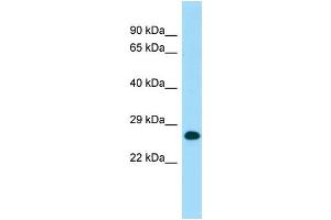 WB Suggested Anti-MOB1A Antibody Titration: 1. (MOB1A 抗体  (C-Term))