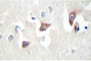 Immunohistochemistry (IHC) analyzes of MRCKbeta antibody in paraffin-embedded human brain tissue. (CDC42BPB 抗体)