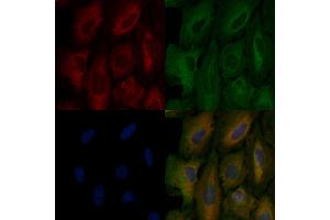 ABIN6257095 and ABIN6275980 staining  cells by IF/ICC. (CNR1 抗体  (N-Term))