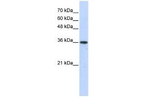 AKR7A3 antibody used at 1 ug/ml to detect target protein. (AKR7A3 抗体)
