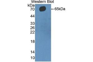 Detection of Recombinant CD5, Human using Polyclonal Antibody to Cluster Of Differentiation 5 (CD5) (CD5 抗体  (AA 25-372))
