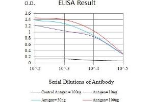 Black line: Control Antigen (100 ng),Purple line: Antigen (10 ng), Blue line: Antigen (50 ng), Red line:Antigen (100 ng) (CTNNBL1 抗体  (AA 390-557))