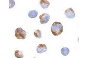 Immunocytochemistry of BMI-1 in K562 cells with AP30158PU-N BMI-1 antibody at 10 μg/ml. (BMI1 抗体  (Intermediate Domain))