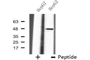 Western blot analysis of extracts from HepG2 cells using B4GALT3 antibody. (B4GALT3 抗体  (Internal Region))