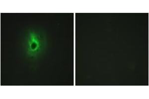 Immunofluorescence analysis of HeLa cells, using Collagen VI alpha3 Antibody. (COL6a3 抗体  (AA 2261-2310))