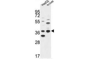 DHRS3 Antibody (Center) western blot analysis in HepG2 cell line and mouse liver tissue lysates (35µg/lane). (DHRS3 抗体  (Middle Region))