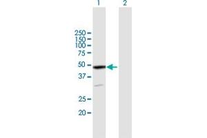 Western Blot analysis of EPB49 expression in transfected 293T cell line by EPB49 MaxPab polyclonal antibody. (Dematin 抗体  (AA 1-383))