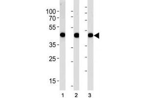 Alpha Actin antibody western blot analysis in (1) A549, (2) RD, and (3) human placenta lysate (Actin 抗体  (AA 346-375))