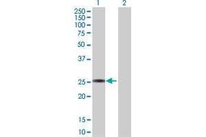 Western Blot analysis of GSTA3 expression in transfected 293T cell line by GSTA3 MaxPab polyclonal antibody. (GSTA3 抗体  (AA 1-222))