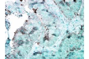 Immunohistochemistry analysis using Mouse Anti-Hsp90 Monoclonal Antibody, Clone 4F3. (HSP90 抗体)