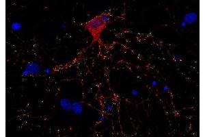 Indirect immunostaining of PFA fixed rat hippocampus neurons with anti-Complexin 1/2 (dilution 1 : 500; red) and mouse anti-synapsin 1 (cat. (Complexin 1, 2 (AA 122-134) 抗体)