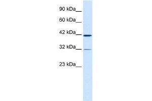 WB Suggested Anti-CHST4 Antibody Titration:  0. (CHST4 抗体  (Middle Region))