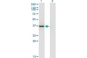 Western Blot analysis of LZTFL1 expression in transfected 293T cell line by LZTFL1 monoclonal antibody (M09), clone 1B1. (LZTFL1 抗体  (AA 39-120))
