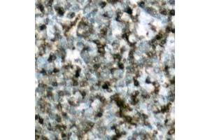 Immunohistochemistry (IHC) image for anti-Cas-Br-M (Murine) Ecotropic Retroviral Transforming Sequence (CBL) (C-Term), (pTyr700) antibody (ABIN7301536)