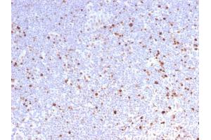 Formalin-fixed, paraffin-embedded human Lymph Node stained with MCM7 Rabbit Recombinant Monoclonal Antibody (MCM7/2832R). (Recombinant MCM7 抗体  (AA 195-319))